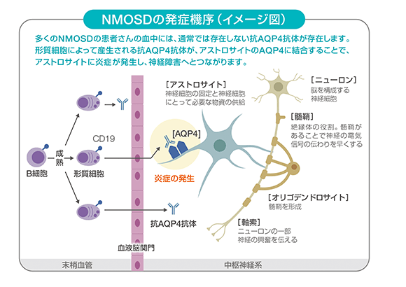 NMOSDの発症機序(イメージ図)