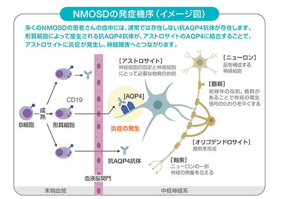 NMSODの作用機序(イメージ図)